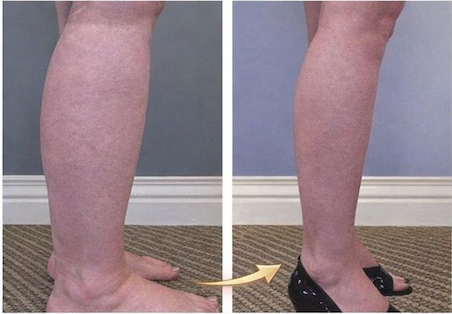 Resultado de Elisa, 47 anos